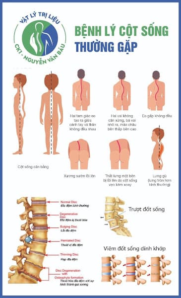 Hình ảnh Vật lý trị liệu - Chuyên khoa 1 - Nguyễn Văn Báu - 5