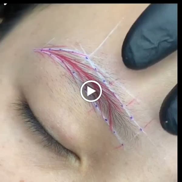 Hình ảnh Thẩm Mỹ Bảo Lân - 4