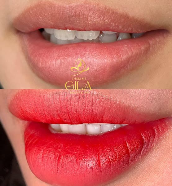 Hình ảnh Thẩm Mỹ Gila Beauty Spa - 2