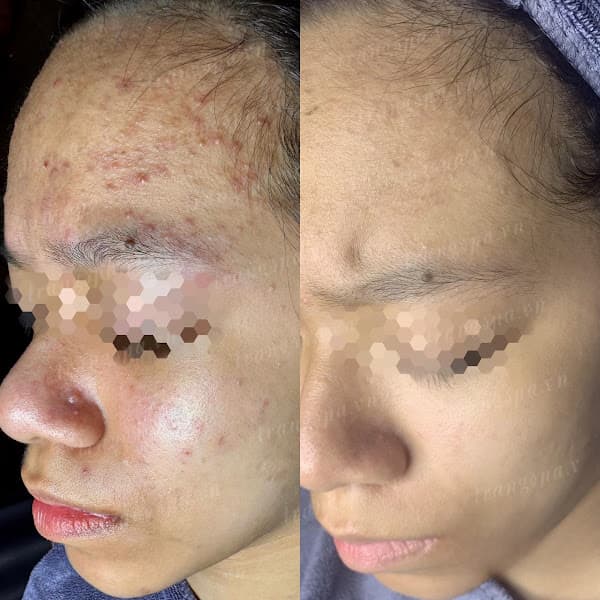 Ảnh bìa Trang Beauty Spa - Phúc Đồng, Long Biên