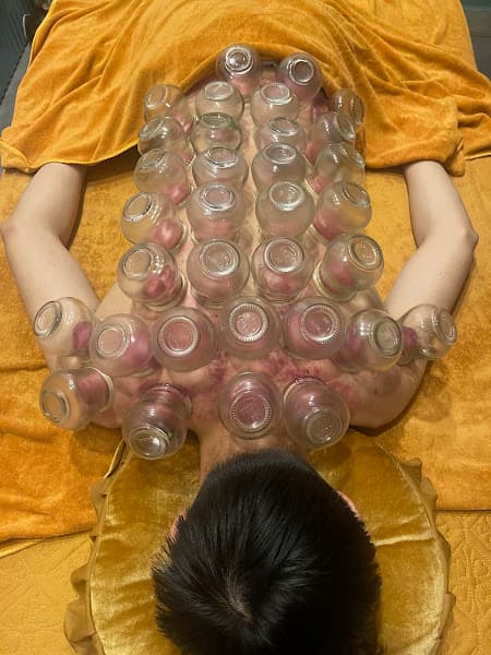 Hình ảnh MASSAGE -TRỊ LIỆU- NHẤN HUYỆT -GIÁC HƠI-Giá rẻ Tại nhà 마사지 받고 싶을 때 전화해 - 4