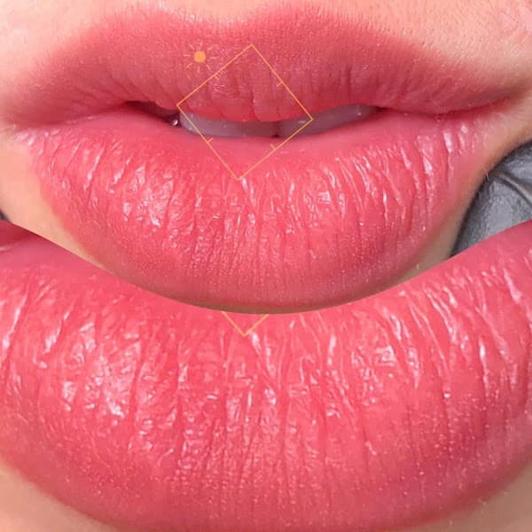 Hình ảnh Thẩm Mỹ Quốc Tế Van Hải Phòng Spa - Beauty Academy - 3