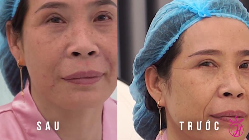 Hình ảnh Hanna Beauty Center - 4