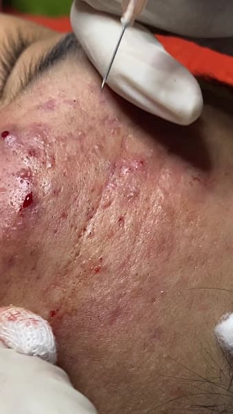 Hình ảnh SPA THẮM ( chăm sóc da - phun xăm thẩm mỹ ) - 3