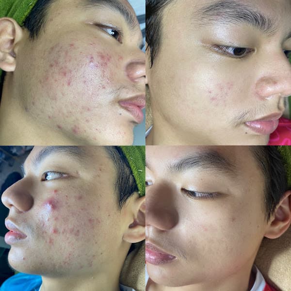 SPA THẮM ( chăm sóc da - phun xăm thẩm mỹ )