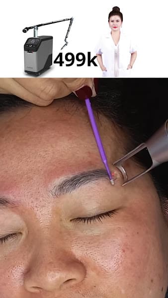 Ảnh bìa My Lơ Spa