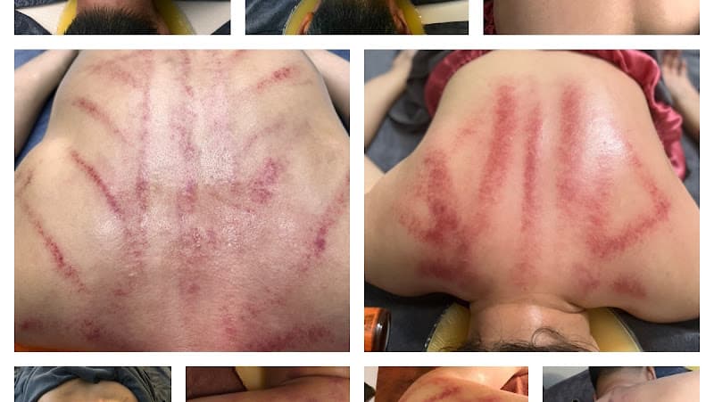 Hình ảnh Massage Châm Cứu Bấm Huyệt Trị Liệu Hoa Đông y - 5