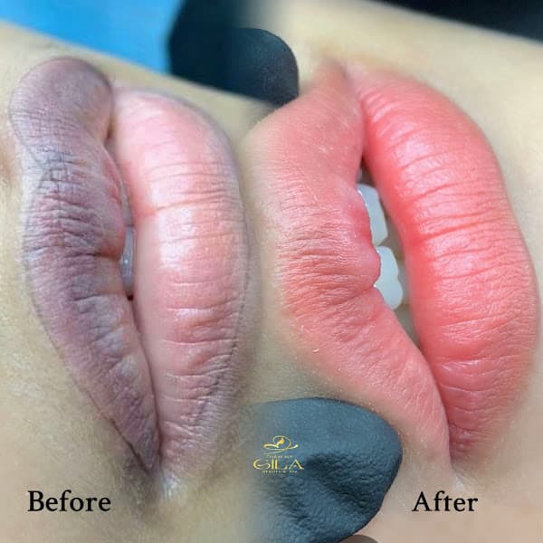 Hình ảnh Thẩm Mỹ Gila Beauty Spa - 3