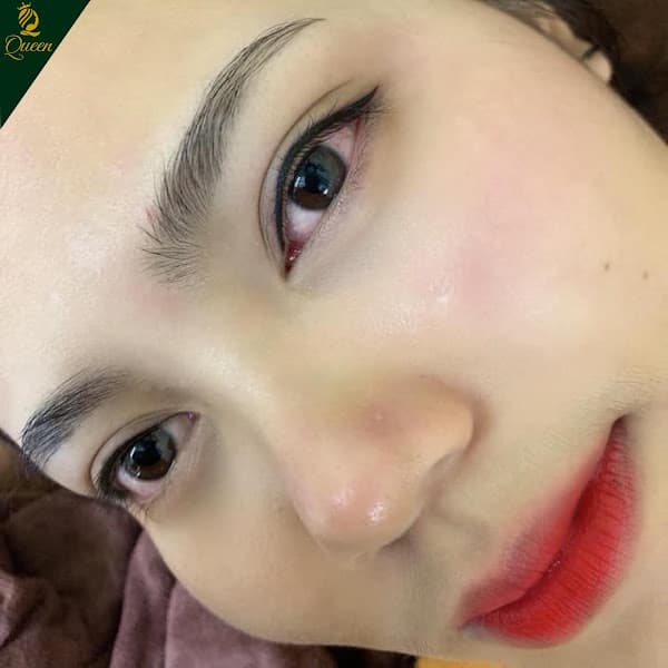 Hình ảnh Thẩm Mỹ Quốc Tế Queen Hà Tĩnh - 2