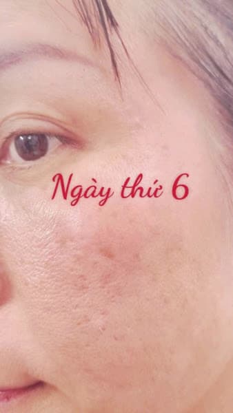 Hình ảnh Spa Vân Du - 2