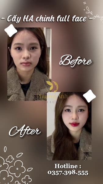 Hình ảnh Phương Anh Spa & Clinic - 3