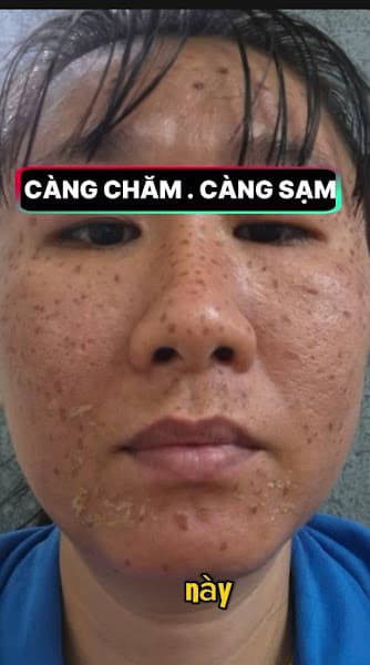 Hình ảnh Spa Trảng Bàng Anh Đào - 4