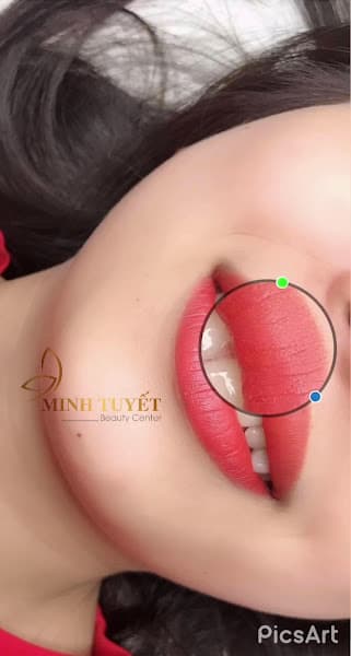 Hình ảnh MINH TUYẾT PREMIUM - 2