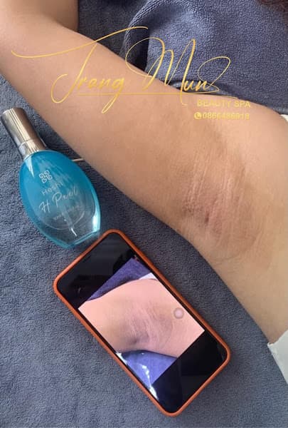 Hình ảnh Spa Trang Mun - Định Quán - Đồng Nai - 2