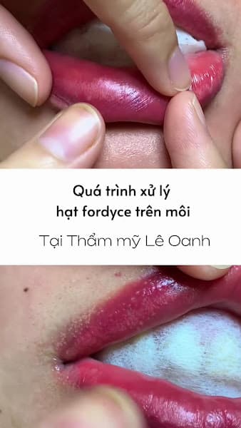 Hình ảnh Spa Lê Oanh Sa Đéc - 3