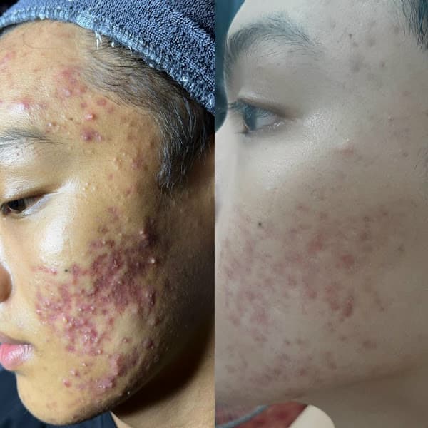 Hình ảnh Spa Trang Mun - Định Quán - Đồng Nai - 4