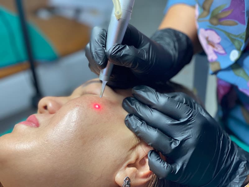 Hình ảnh Lâm Kiều Spa Tây Ninh chuyên Trị mụn - Trị nám - Trị sẹo - Xóa mụn thịt và Xoá xăm Tây Ninh - 4
