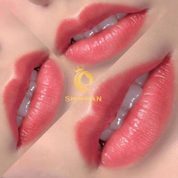 Hình ảnh Viện Thẩm Mỹ Quốc Tế Shinhan - Tây Ninh - 4