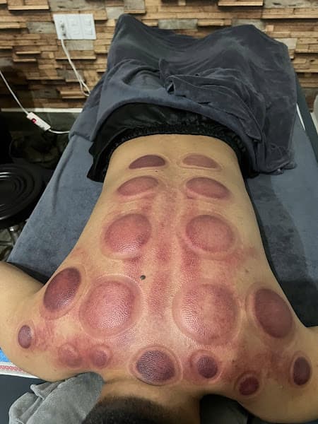 Hình ảnh MASSAGE -TRỊ LIỆU- NHẤN HUYỆT -GIÁC HƠI-Giá rẻ Tại nhà 마사지 받고 싶을 때 전화해 - 2