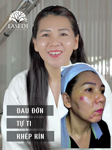 Ảnh bìa Phòng khám da liễu Lasedi Bảo Lộc